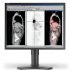 NEC MD21M: монитор для цветной рентгенографии 